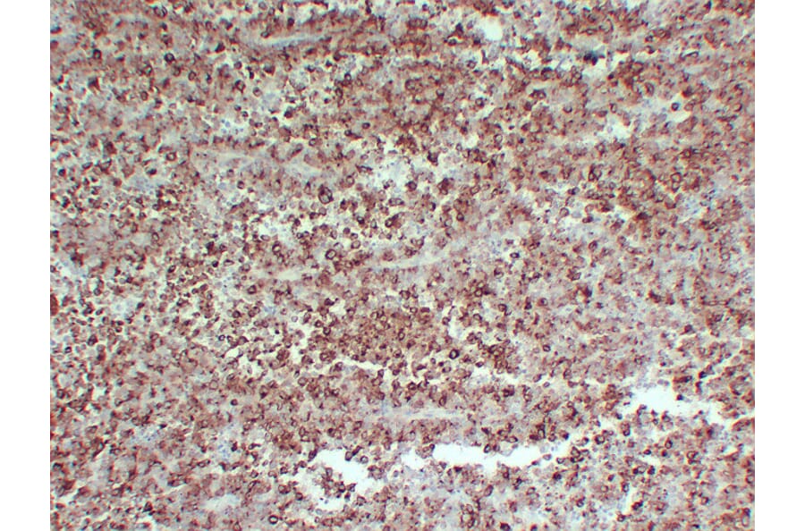 Immunohistochemistry - Anti-PMEL Antibody (V0113) - Antibodies.com