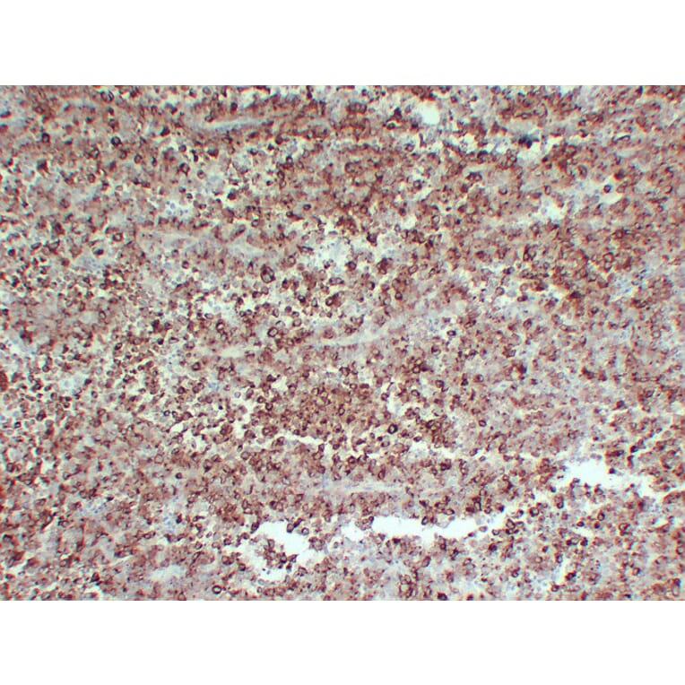 Immunohistochemistry - Anti-PMEL Antibody (V0113) - Antibodies.com