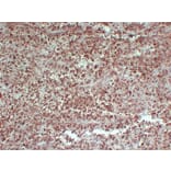 Immunohistochemistry - Anti-PMEL Antibody (V0113) - Antibodies.com