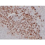 Immunohistochemistry - Anti-MUC6 Antibody (V0098) - Antibodies.com