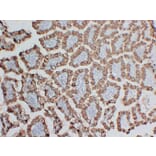 Immunohistochemistry - Anti-MUC2 Antibody (V0096) - Antibodies.com