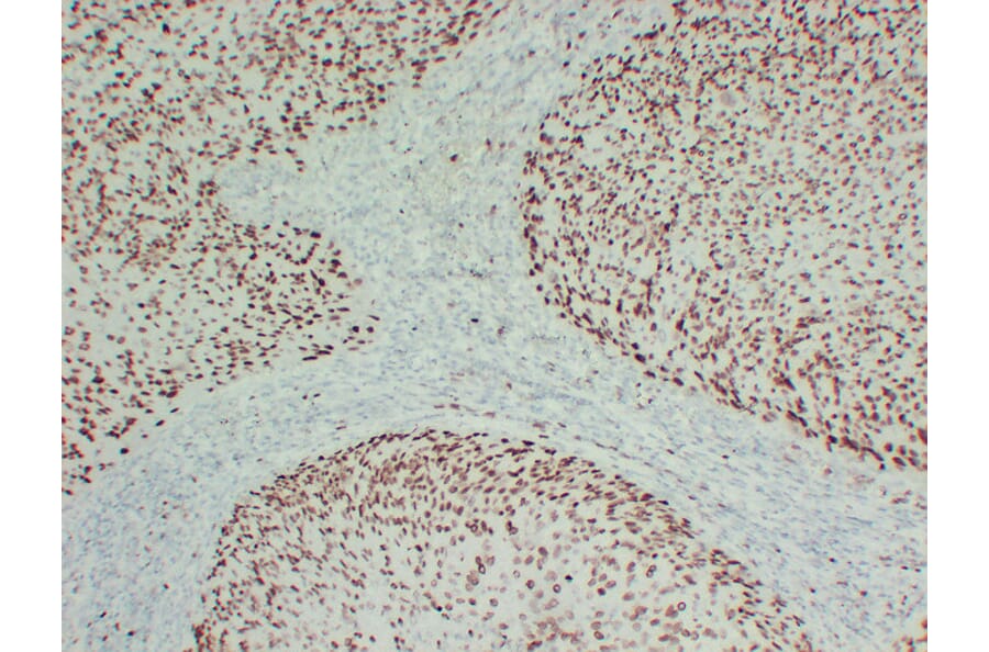 Immunohistochemistry - Anti-MCM2 Antibody (V0093) - Antibodies.com