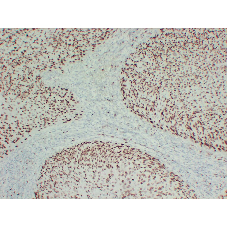 Immunohistochemistry - Anti-MCM2 Antibody (V0093) - Antibodies.com