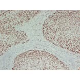 Immunohistochemistry - Anti-MCM2 Antibody (V0093) - Antibodies.com