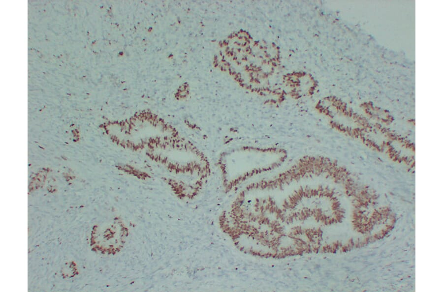Immunohistochemistry - Anti-MCM2 Antibody (V0093) - Antibodies.com