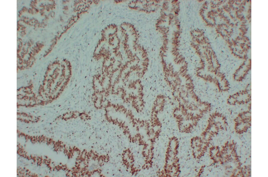 Immunohistochemistry - Anti-MCM2 Antibody (V0093) - Antibodies.com