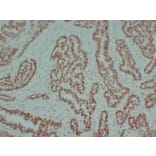 Immunohistochemistry - Anti-MCM2 Antibody (V0093) - Antibodies.com