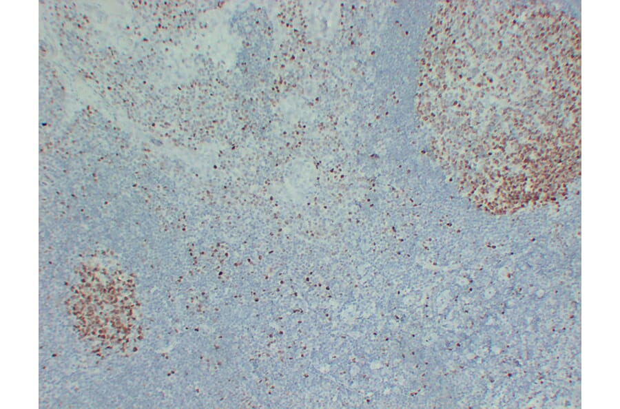 Immunohistochemistry - Anti-MCM2 Antibody (V0093) - Antibodies.com