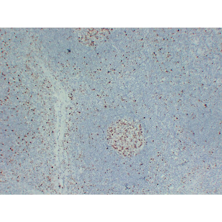 Immunohistochemistry - Anti-MCM2 Antibody (V0093) - Antibodies.com