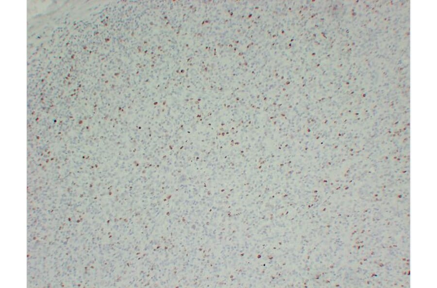 Immunohistochemistry - Anti-Ki67 Antibody (V0088) - Antibodies.com