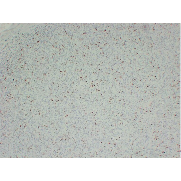 Immunohistochemistry - Anti-Ki67 Antibody (V0088) - Antibodies.com