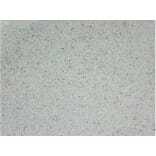 Immunohistochemistry - Anti-Ki67 Antibody (V0088) - Antibodies.com