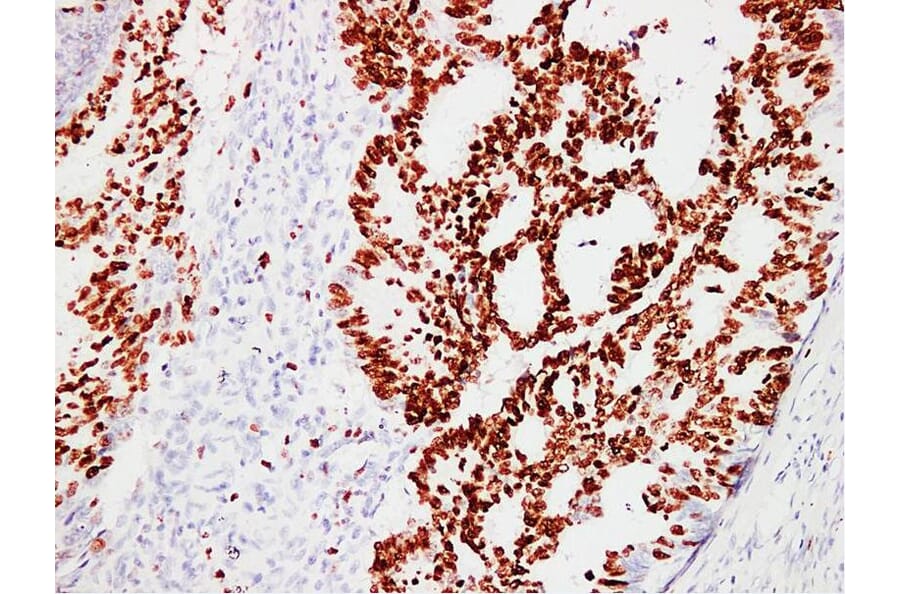 Immunohistochemistry - Anti-Ki67 Antibody (V0088) - Antibodies.com