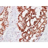 Immunohistochemistry - Anti-Ki67 Antibody (V0088) - Antibodies.com