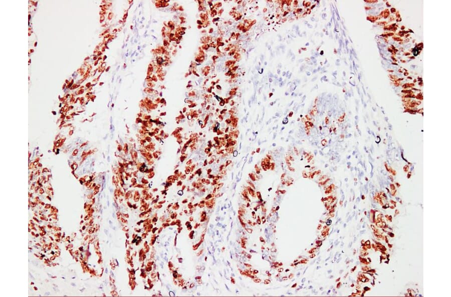 Immunohistochemistry - Anti-Ki67 Antibody (V0088) - Antibodies.com