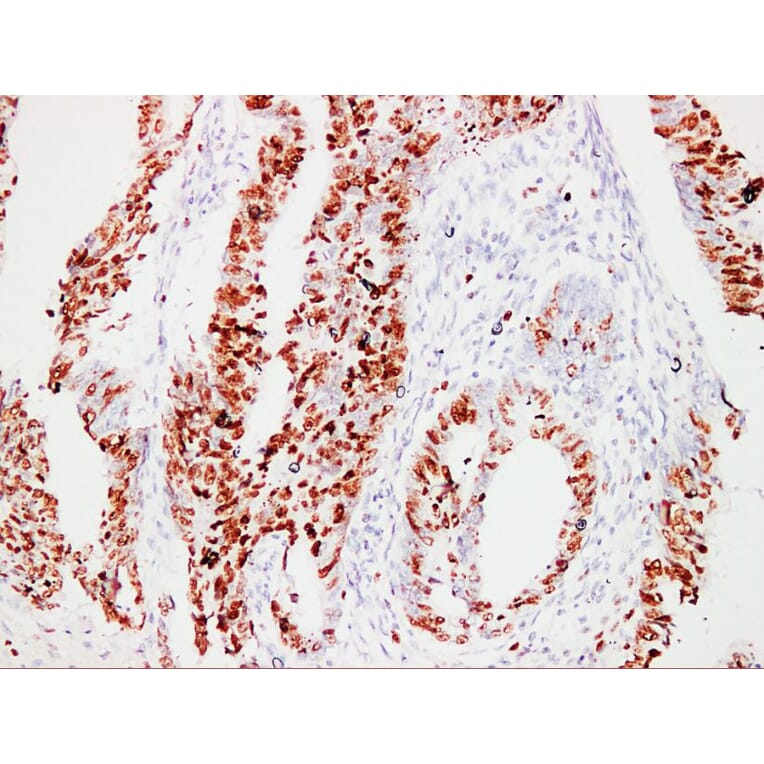 Immunohistochemistry - Anti-Ki67 Antibody (V0088) - Antibodies.com