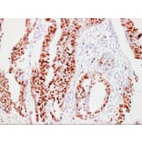 Immunohistochemistry - Anti-Ki67 Antibody (V0088) - Antibodies.com