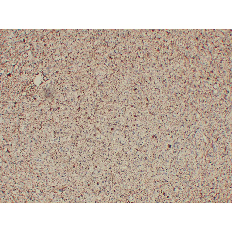 Immunohistochemistry - Anti-GFAP Antibody (V0076) - Antibodies.com