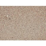 Immunohistochemistry - Anti-GFAP Antibody (V0076) - Antibodies.com