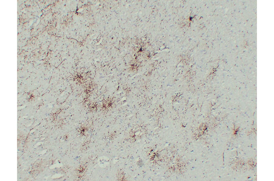 Immunohistochemistry - Anti-GFAP Antibody (V0076) - Antibodies.com