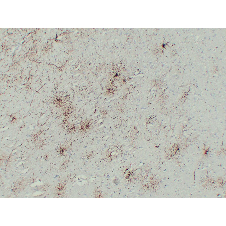 Immunohistochemistry - Anti-GFAP Antibody (V0076) - Antibodies.com