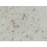 Immunohistochemistry - Anti-GFAP Antibody (V0076) - Antibodies.com