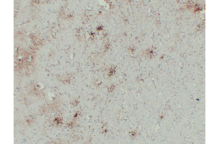 Immunohistochemistry - Anti-GFAP Antibody (V0076) - Antibodies.com