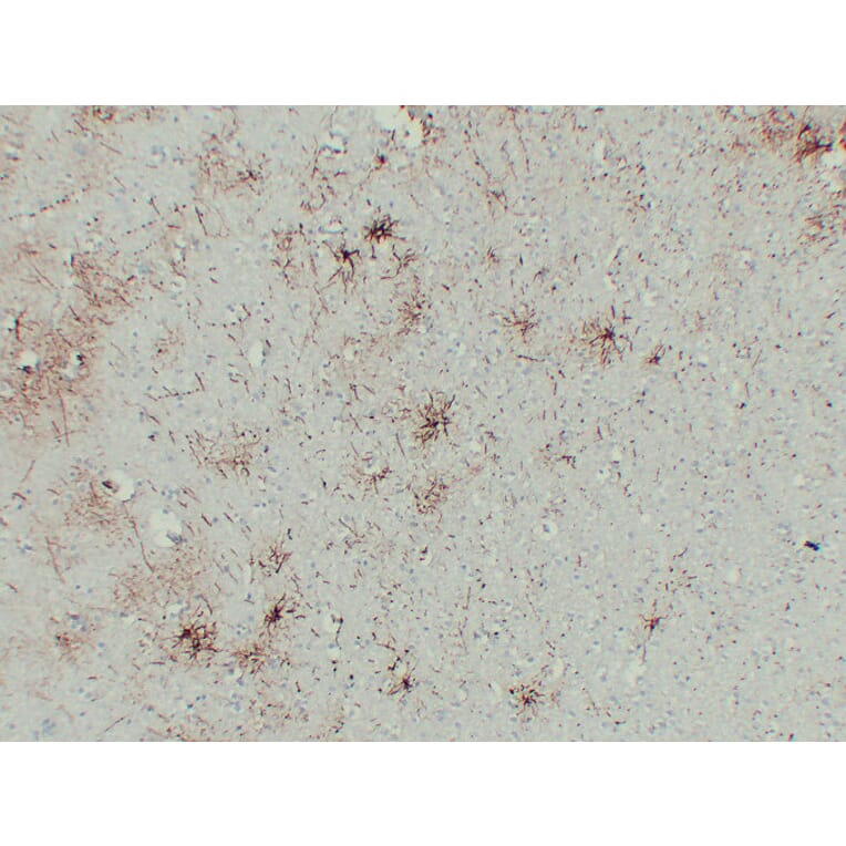 Immunohistochemistry - Anti-GFAP Antibody (V0076) - Antibodies.com