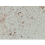 Immunohistochemistry - Anti-GFAP Antibody (V0076) - Antibodies.com