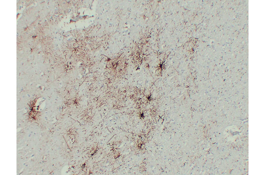 Immunohistochemistry - Anti-GFAP Antibody (V0076) - Antibodies.com
