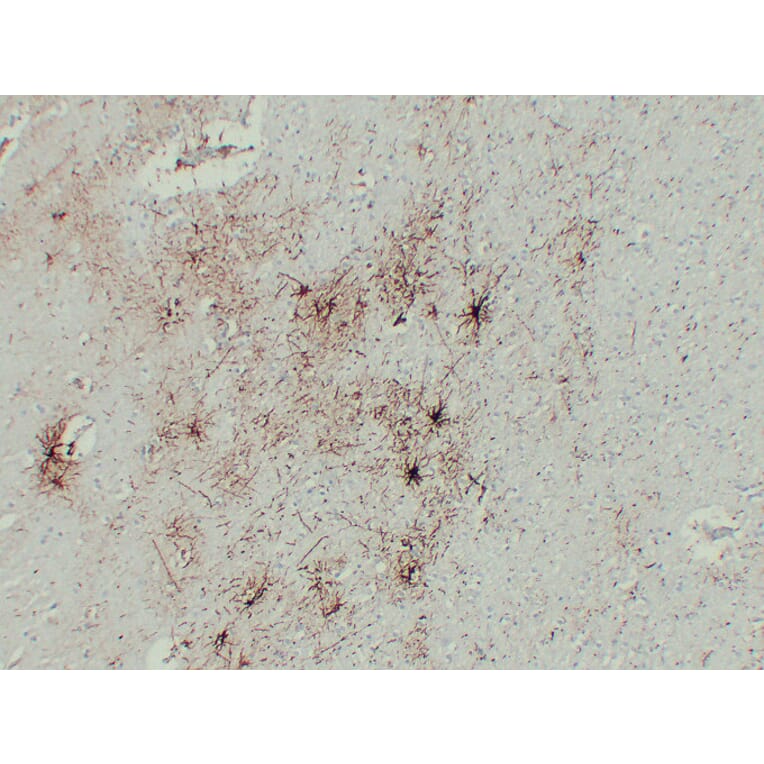 Immunohistochemistry - Anti-GFAP Antibody (V0076) - Antibodies.com