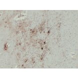 Immunohistochemistry - Anti-GFAP Antibody (V0076) - Antibodies.com