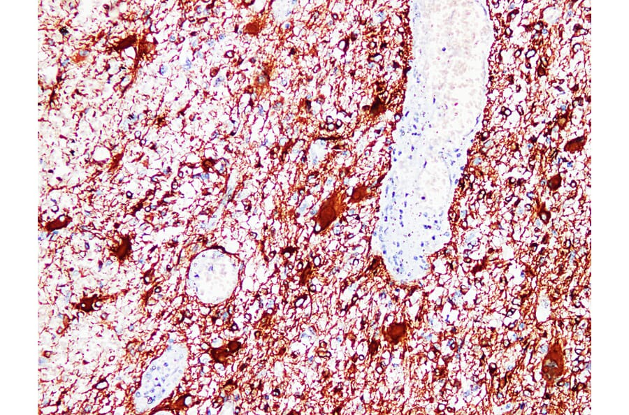 Immunohistochemistry - Anti-GFAP Antibody (V0076) - Antibodies.com