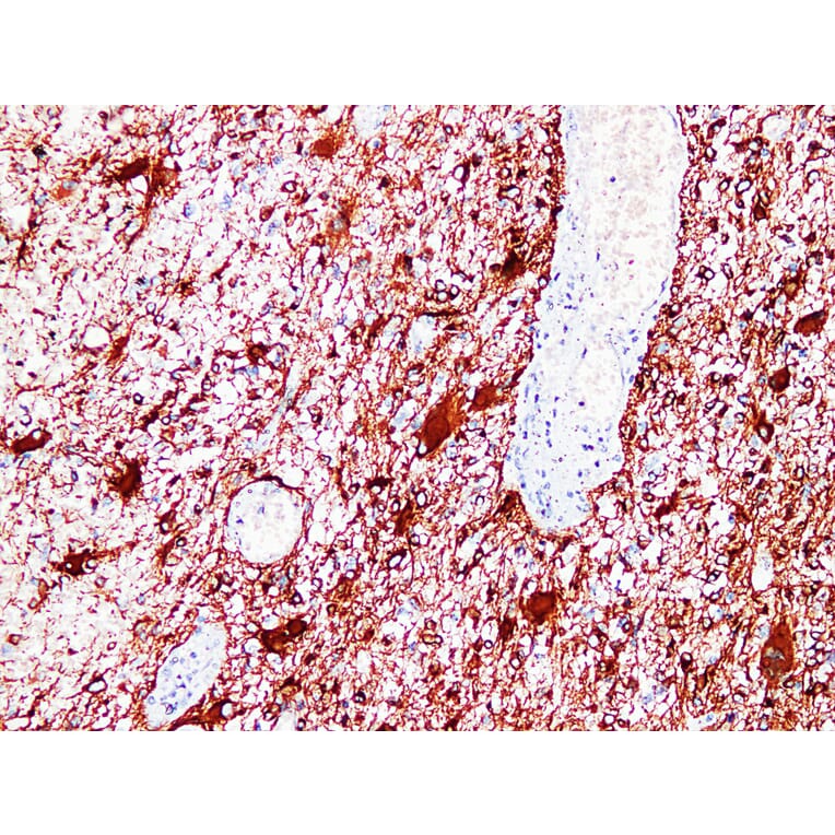 Immunohistochemistry - Anti-GFAP Antibody (V0076) - Antibodies.com