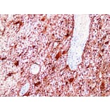 Immunohistochemistry - Anti-GFAP Antibody (V0076) - Antibodies.com