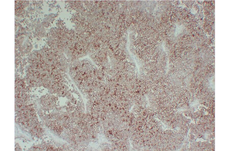 Immunohistochemistry - Anti-CD99 Antibody (V0039) - Antibodies.com