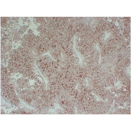 Immunohistochemistry - Anti-CD99 Antibody (V0039) - Antibodies.com