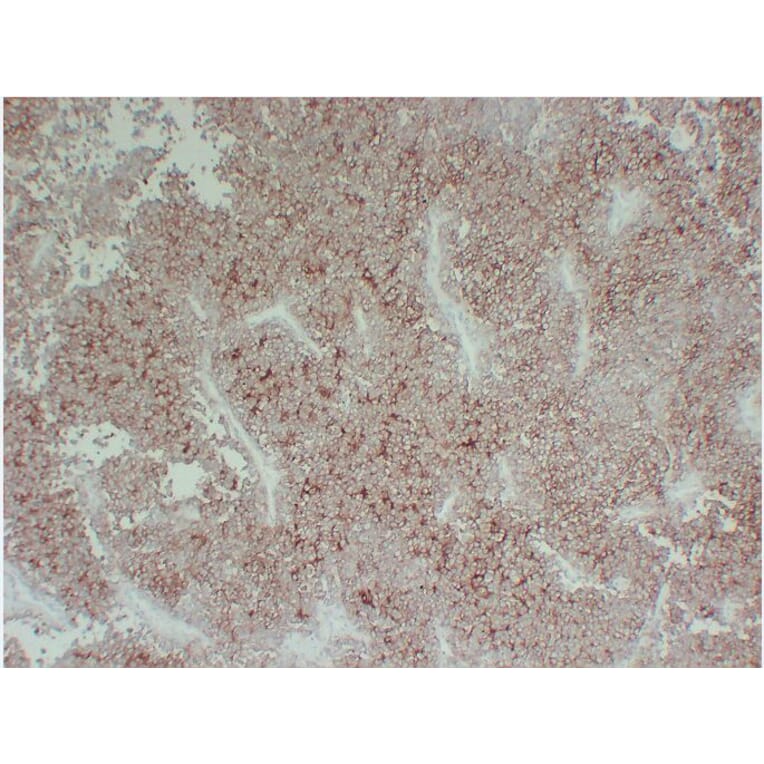 Immunohistochemistry - Anti-CD99 Antibody (V0039) - Antibodies.com