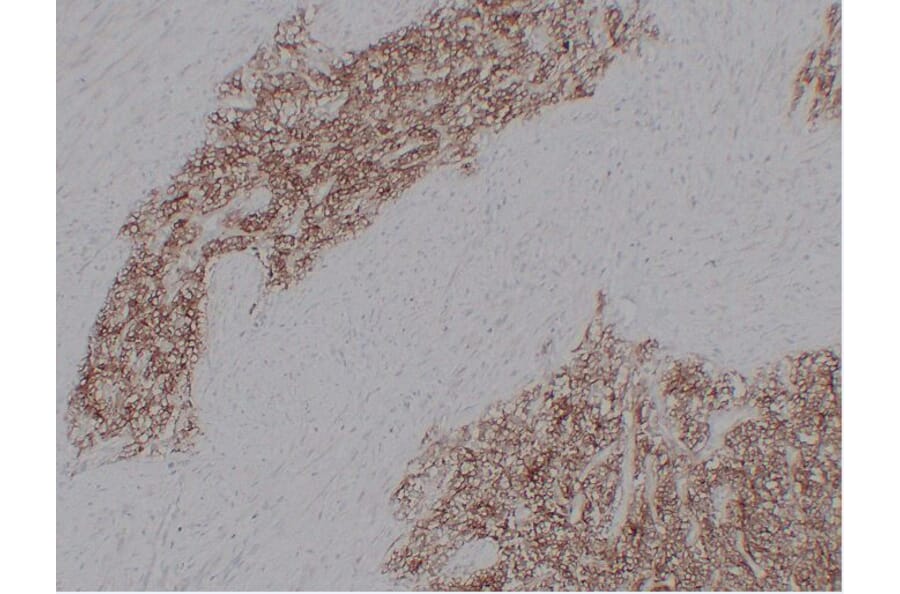 Immunohistochemistry - Anti-CD99 Antibody (V0039) - Antibodies.com