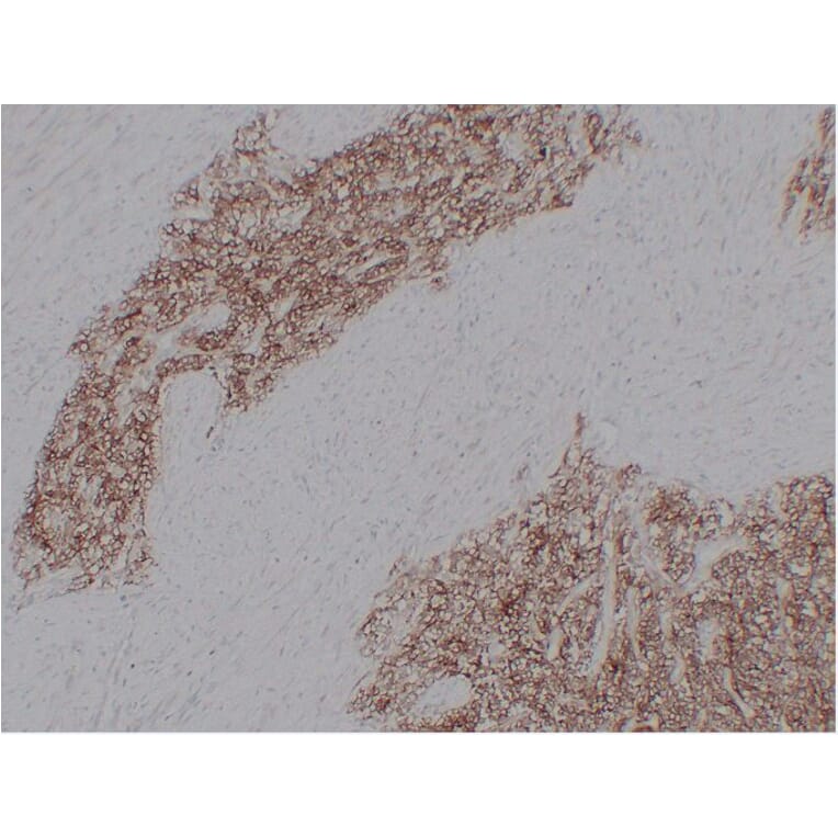 Immunohistochemistry - Anti-CD99 Antibody (V0039) - Antibodies.com