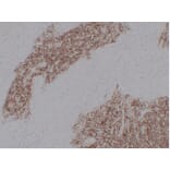 Immunohistochemistry - Anti-CD99 Antibody (V0039) - Antibodies.com
