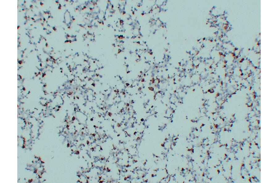 Immunohistochemistry - Anti-CD68 Antibody (V0035) - Antibodies.com