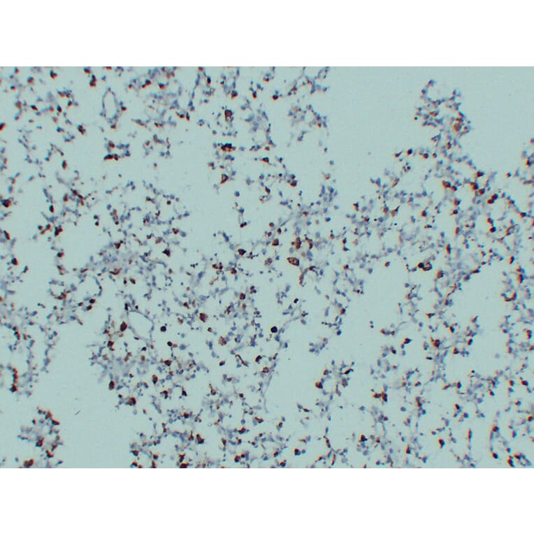 Immunohistochemistry - Anti-CD68 Antibody (V0035) - Antibodies.com