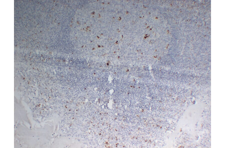 Immunohistochemistry - Anti-CD68 Antibody (V0035) - Antibodies.com