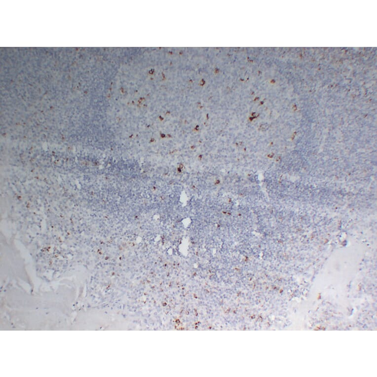 Immunohistochemistry - Anti-CD68 Antibody (V0035) - Antibodies.com