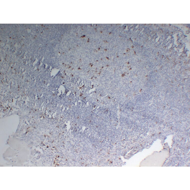Immunohistochemistry - Anti-CD68 Antibody (V0035) - Antibodies.com