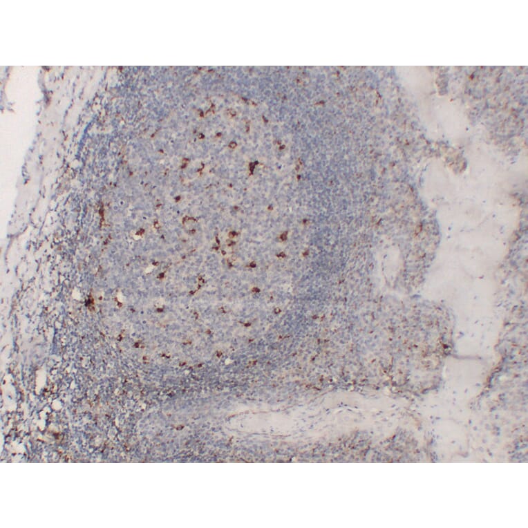 Immunohistochemistry - Anti-CD68 Antibody (V0035) - Antibodies.com