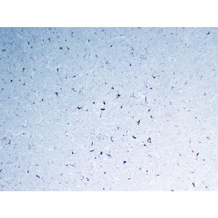 Immunohistochemistry - Anti-CD68 Antibody (V0035) - Antibodies.com