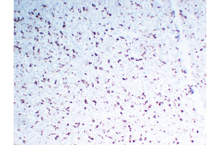 Immunohistochemistry - Anti-CD68 Antibody (V0035) - Antibodies.com