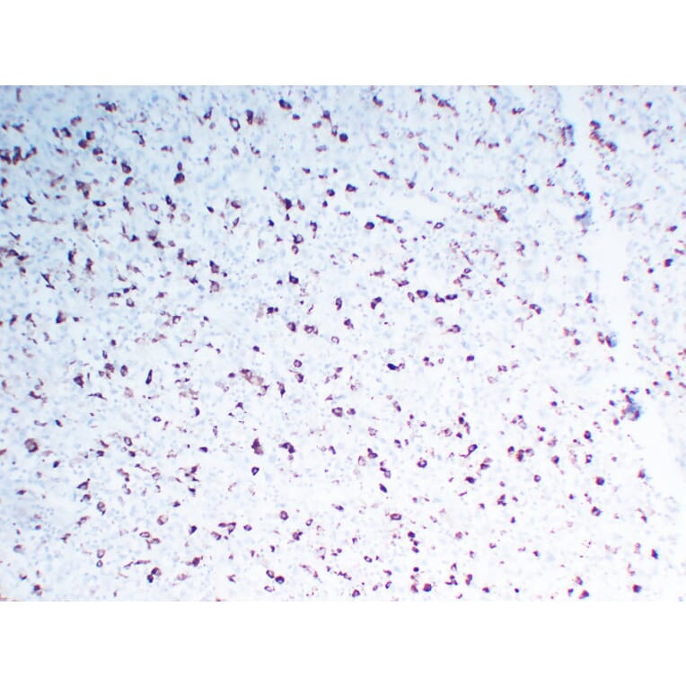 Immunohistochemistry - Anti-CD68 Antibody (V0035) - Antibodies.com